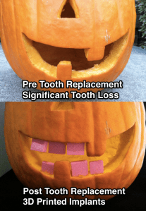 PumpkinTooth1